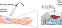 Application of biodegradable piezoelectric PLLA nanofibers on a wound in combination with external ultrasound to produce controllable surface charge for wound healing and prevention of bacterial infection. The biocompatible scaffold facilitates tissue ingrowth for skin healing and prevents bacterial infections. Reproduced with permission from: Das et al., Biomaterials 301 (2023) 122270.